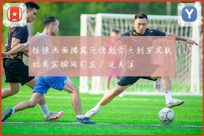 惊悚画面揭露范德彪骨头刺穿皮肤的真实瞬间引发广泛关注